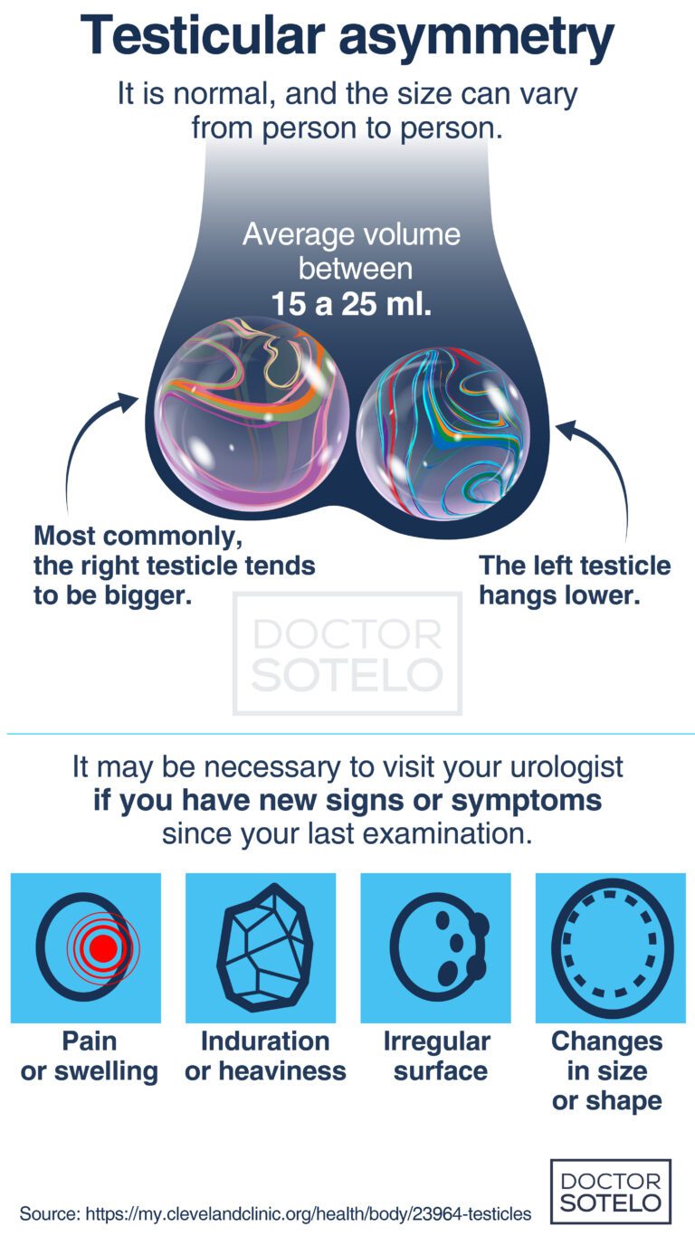 Testicular asymmetry