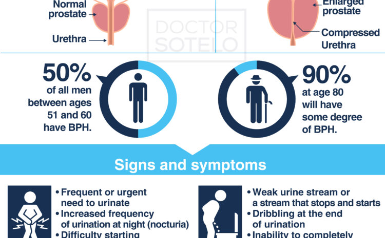  Benign prostatic hyperplasia