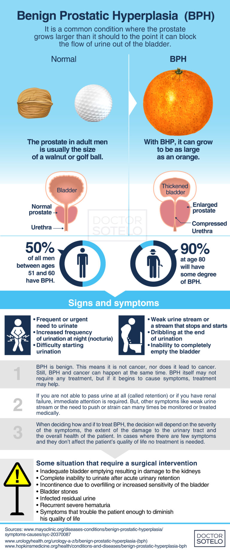 Benign prostatic hyperplasia