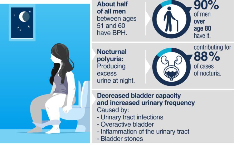  Nocturia