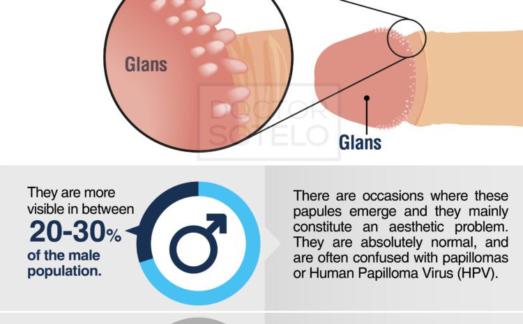  Pearly papules