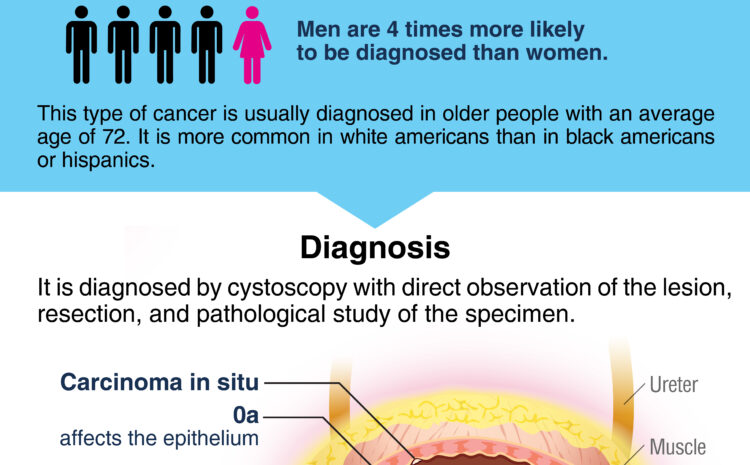  Bladder Cancer