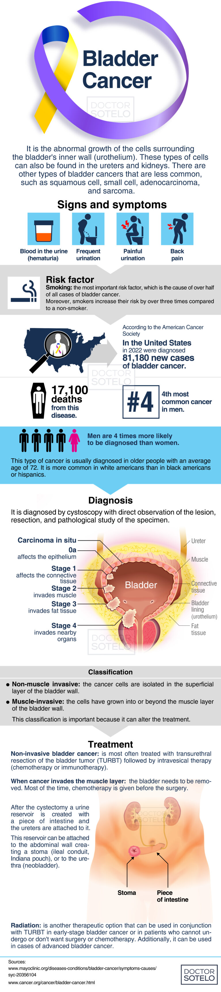 Bladder Cancer