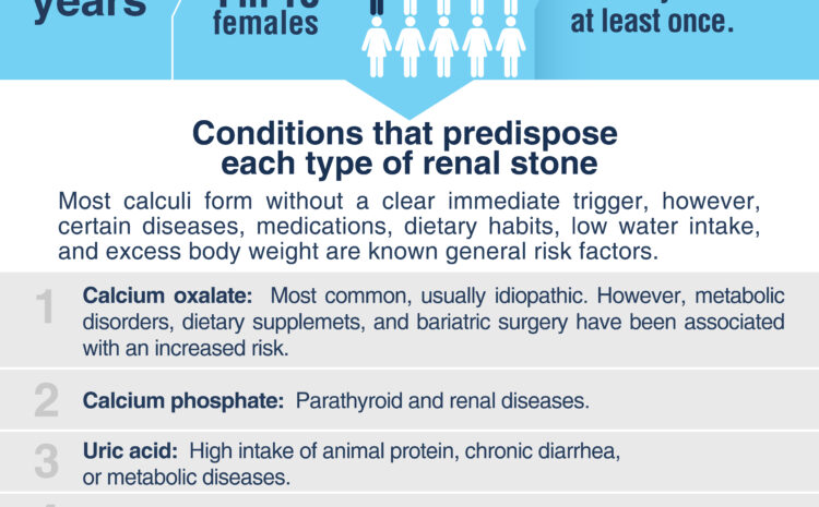  Kidney stones