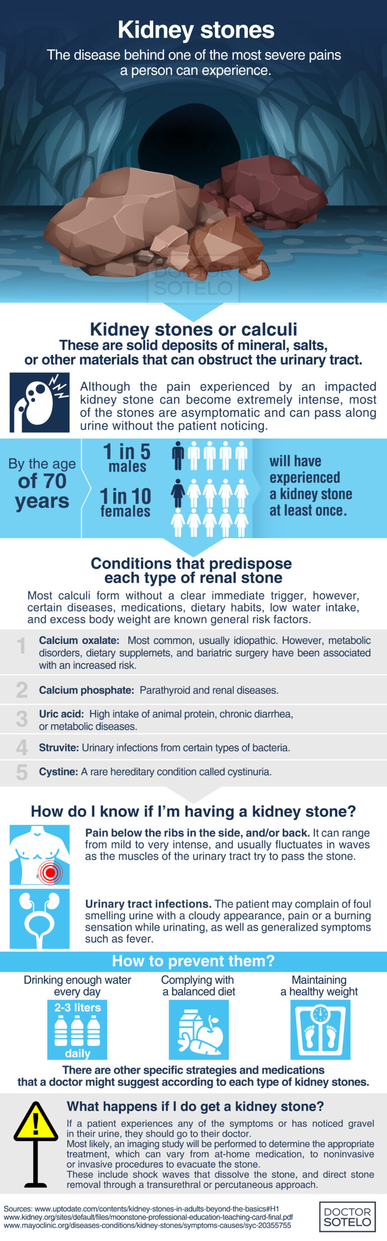 Kidney stones