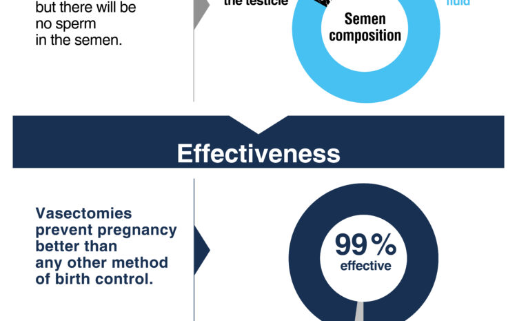  Vasectomy