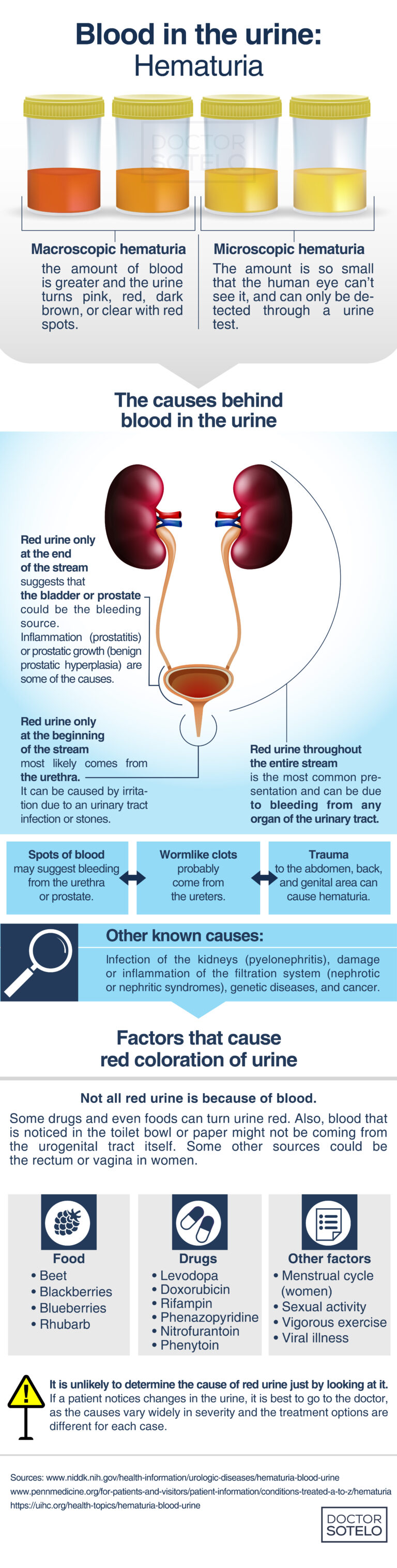 HEMATURIA