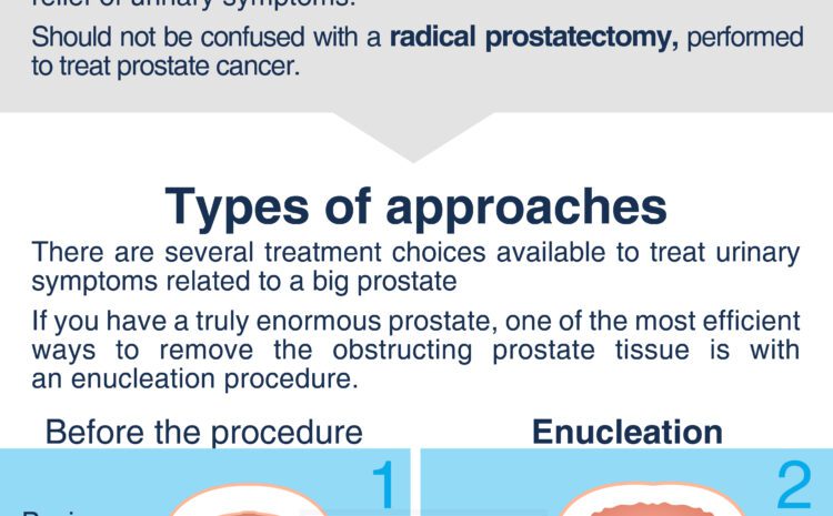  Robotic Simple Prostatectomy