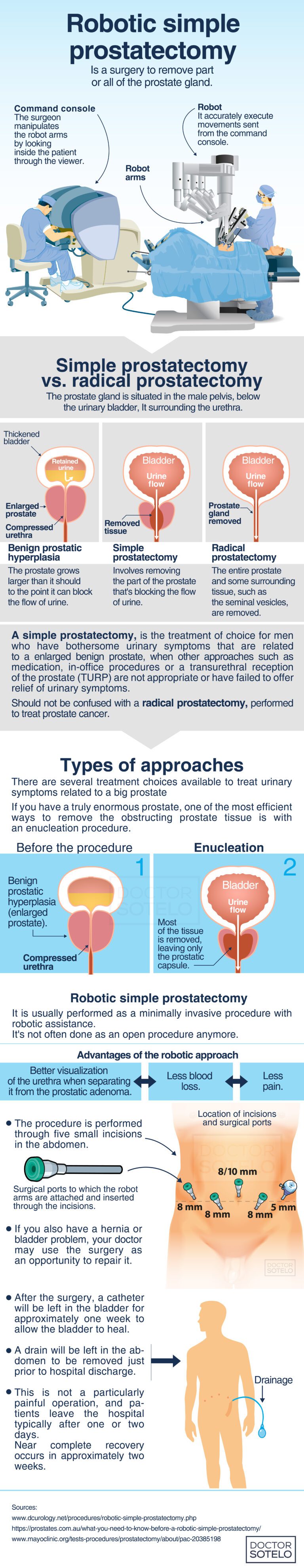 Robotic Simple Prostatectomy