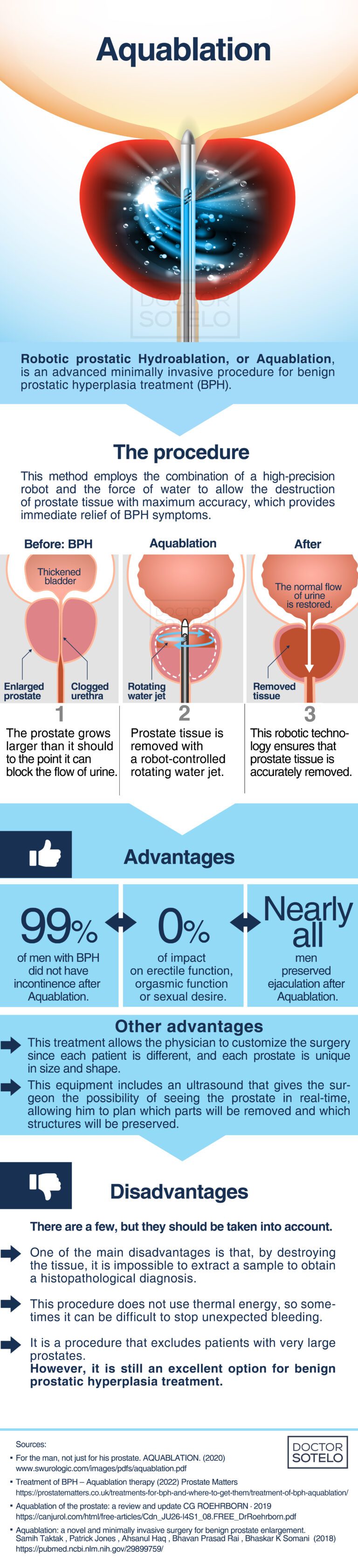 Alternatives for the treatment of benign prostatic hyperplasia: Aquablation