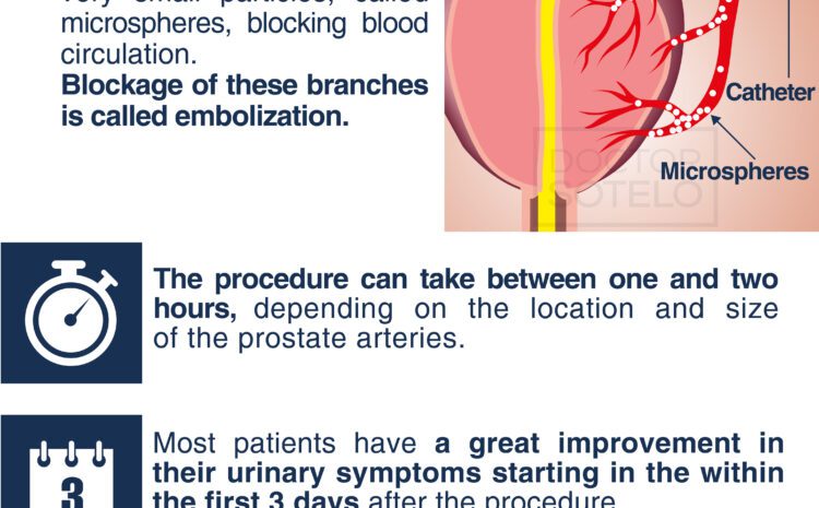  ARE THERE OTHER NON-SURGICAL ALTERNATIVES FOR THE TREATMENT OF BENIGN PROSTATIC HYPERPLASIA?